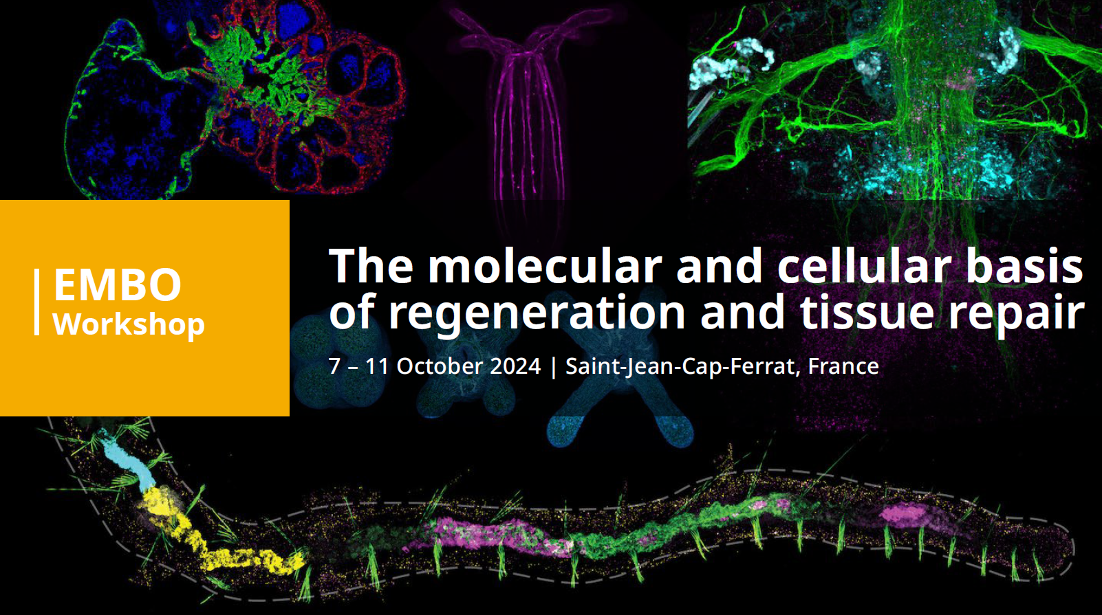 EMBO workshop « The molecular and cellular basis of regeneration and tissue repair »